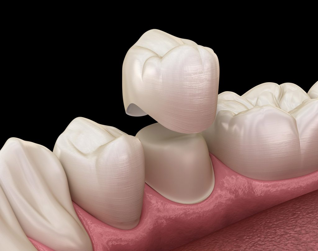 Gentle Care Dentistry & Implant