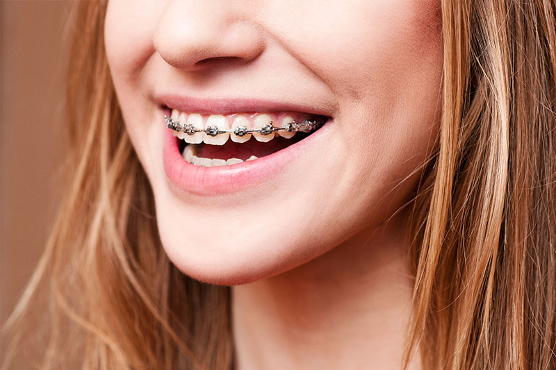 Valley Pediatric Dentistry